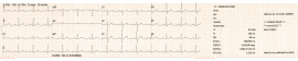 ECG MACHINE 3 CHAN  (ECGMAC-EM301)  EA