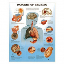 CHART DANGERS OF SMOKING 51CMX66CM