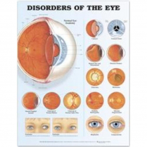 ANATOMY CHART DISORDERS OF THE EYE (DEYE)