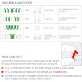 Bioclear Full Anterior Matrix Kit (135 Matrices)