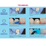 eCement Universal D/C Dual Syringe (8gm)