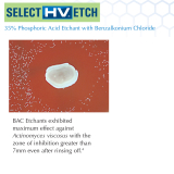 Select HV Etch 35% w/ BAC Kit (30ml)