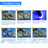 TheraBase Ca Self Adhesive Base Liner Syr 8gm