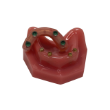 Locator Fixed Patient Model