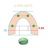 Locator Fixed Silver Starter Kit