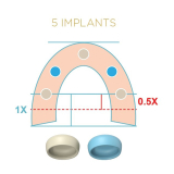 Locator Fixed Blue Mid-Arch Insert Case Processing Pk