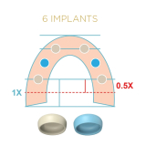 Locator Fixed Blue Mid-Arch Insert Case Processing Pk