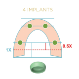 Locator Fixed Green Insert 4 Unit Implant Case Processing Pk