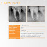 BIO C Sealer 2gm (4 x 0.5gm)